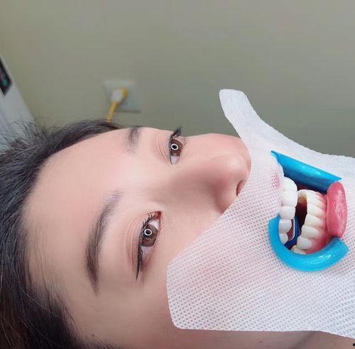齿雕美牙视频,揭秘牙齿美容的神奇之旅